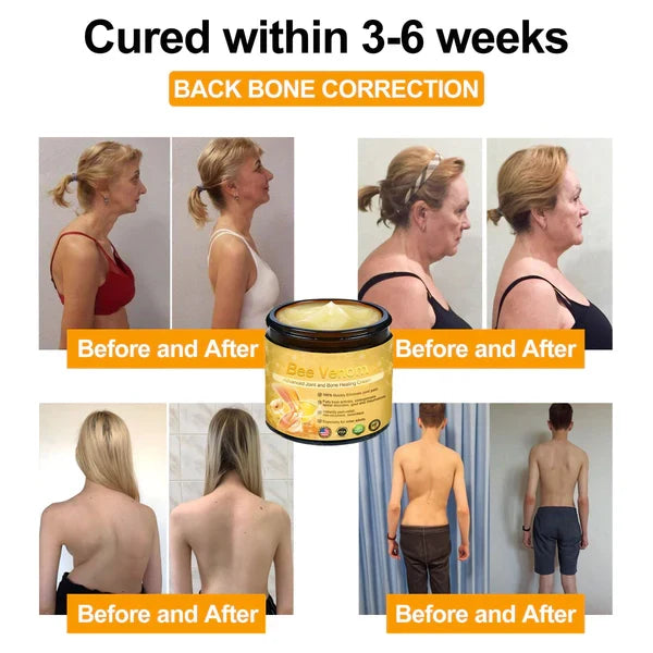 Mayo Clinic recommends👨‍⚕️: Bee Venom Advanced Joint and Bone Healing Cream